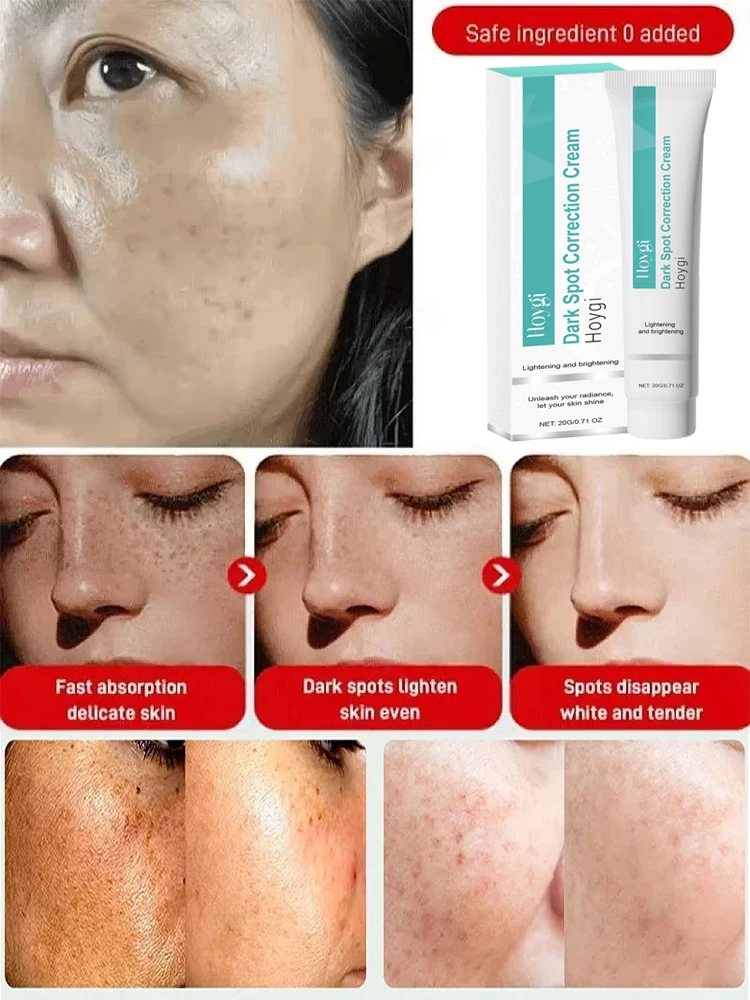 Potente crema sbiancante per l - Luxury Skincare Brands recensione e prezzo