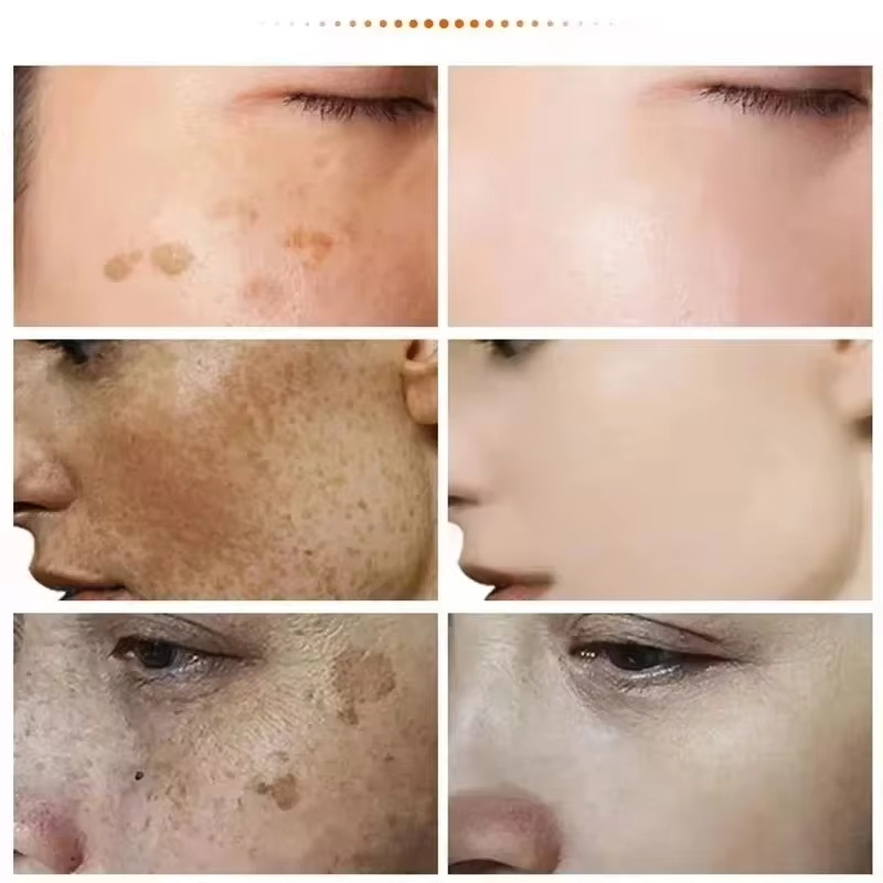 Potente crema sbiancante per l - Luxury Skincare Brands recensione e prezzo