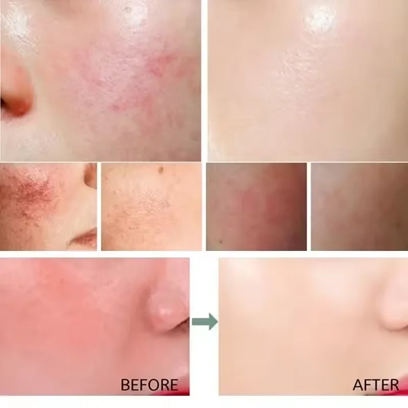 Crema riparatrice per il rosso - Luxury Skincare Brands recensione e prezzo